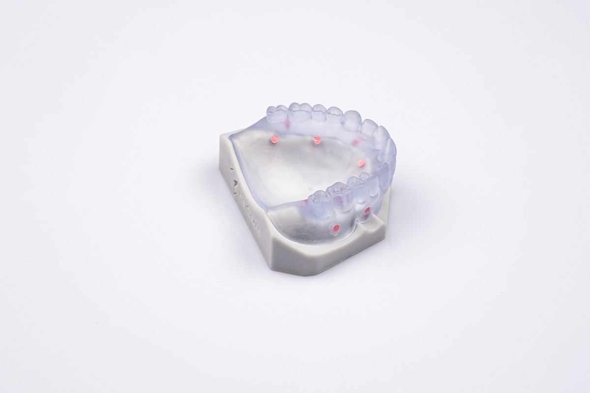 种植手术导板树脂 - 3D打印材料-黑格科技