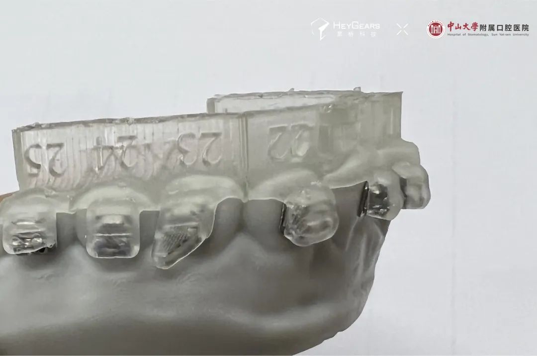 黑格科技和中山大学光华附属口腔医院正畸合作病例